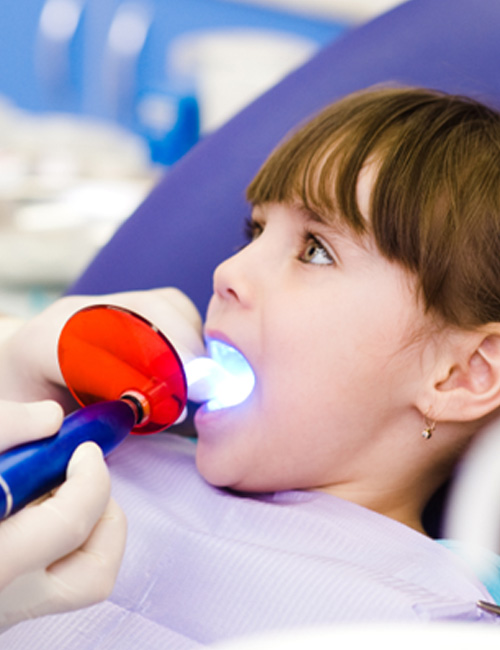 Curing light being used to harden a child’s tooth-colored filling